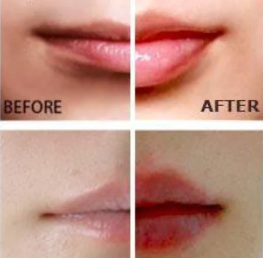 Miracle Lip Plumper XivoraShop